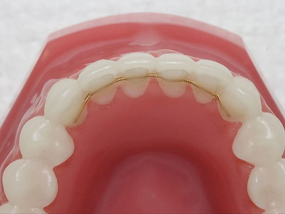 Retainer3_403-1920w.jpg