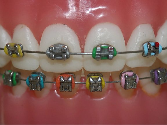 Metallbracketskonventionell_673-1920w.jpg